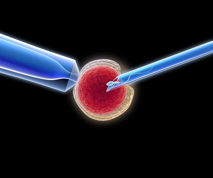 icsi, künstliche Befruchtung, Spermien werden in Eizell injiziert