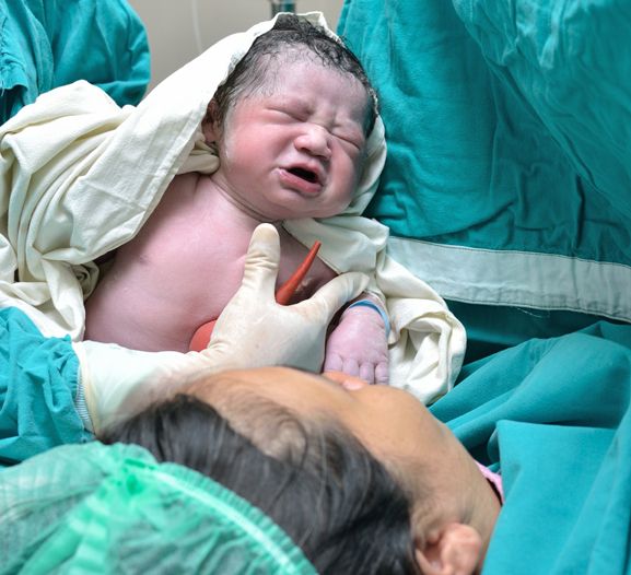 Kurz nach dem Kaiserschnitt