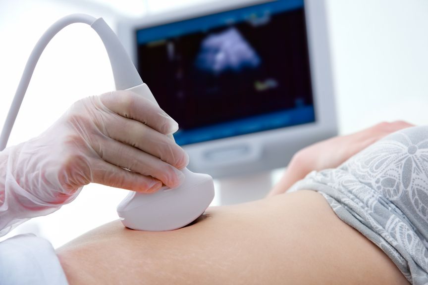 Schwangere bei der  Vorsorgeuntersuchung mit Ultraschall,Ultraschalluntersuchung