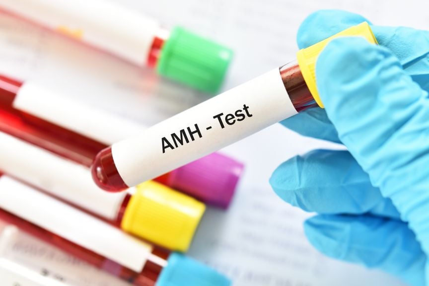 AMH - Test