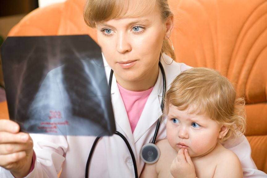 Ärztin mit Kind auf dem Schoss schaut Röntgenbild an