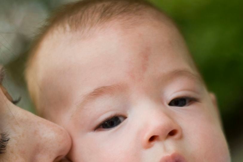 Mutter küsst Baby mit Storchenbiss auf der Stirn