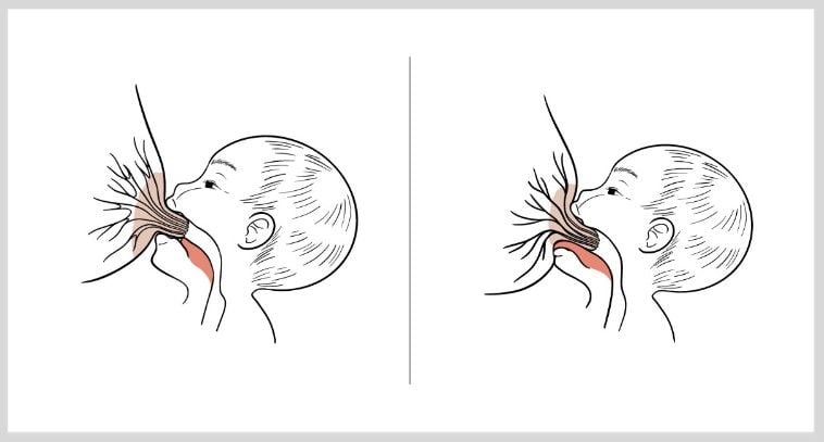 Illustration richtig Anlegen