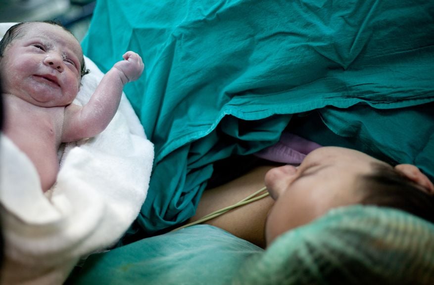 Neugeborenes wenige Minuten nach dem Kaiserschnitt