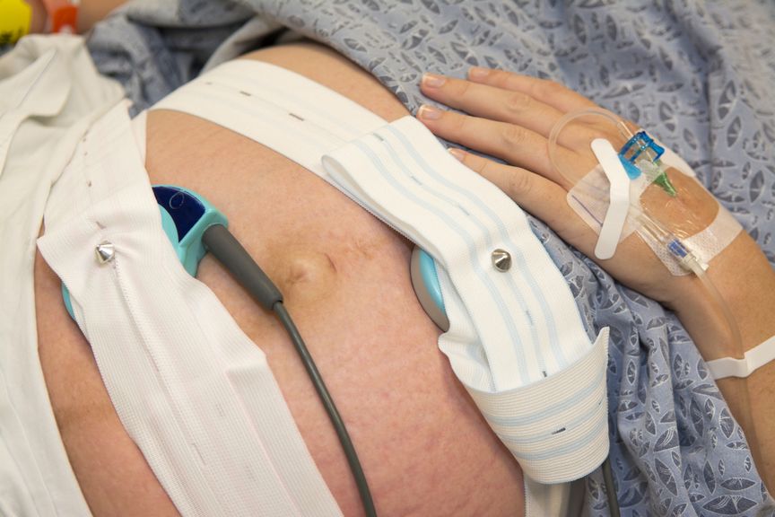 Herzschlagmonitor am Babybauch und IV Katheter an der Hand der Mutter