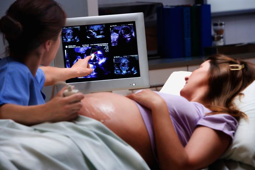 Schwangere beim Ultraschall