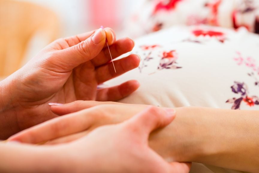Bildausschnitt einer schwangeren Frau, die eine Akupunkturbehandlung bekommt
