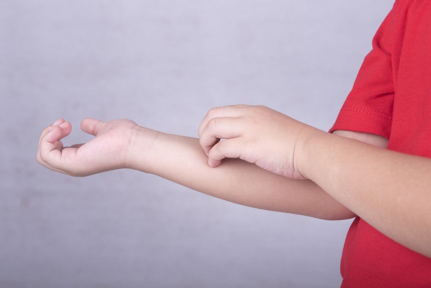 Kind kratzt sich am Arm