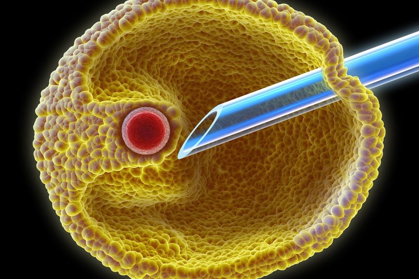Eizellentnahme zur künstlichen Befruchtung IVF