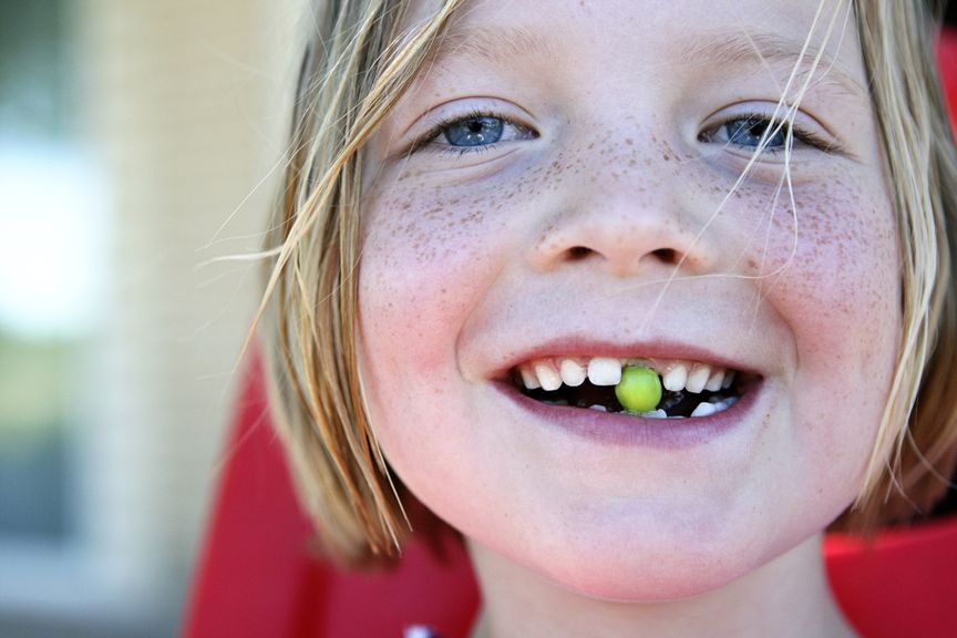 Lachendes Kind mit Zahnlücke und Erbse im Mund