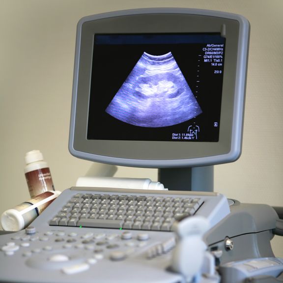 Ultraschallbild auf Monitor