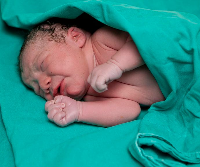 Neugeborenes in OP-Tücher gewickelt