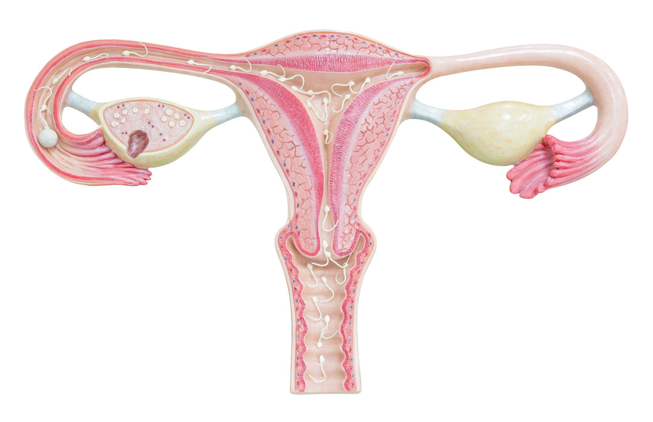 Die gebärmutter in eindringen Scheide (Vagina),