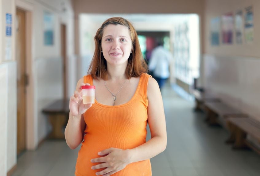 Schwangere mit einer Urinprobe im Glas