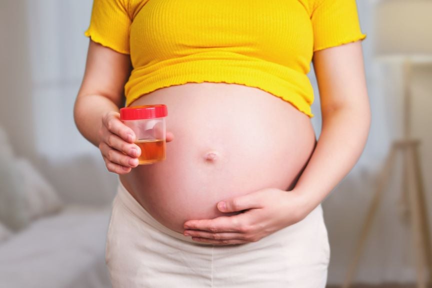 Urinprobe in der Schwangerschaft