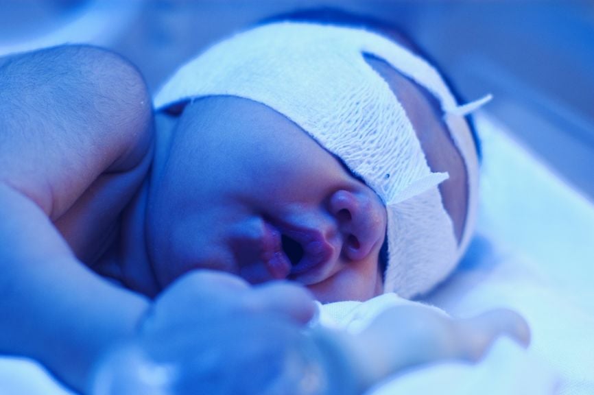 Neugeborenes unter dem UV LIcht 