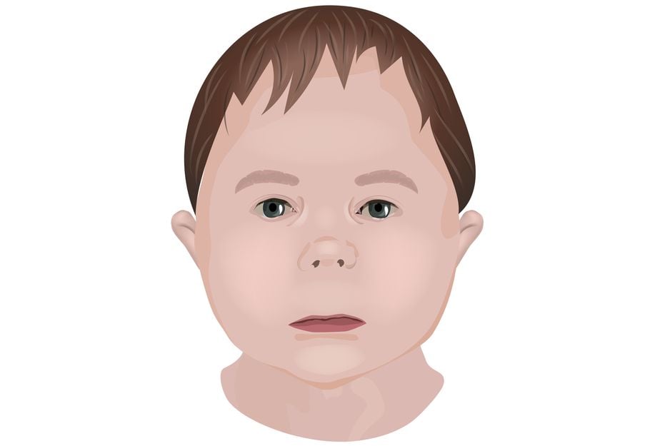 Illustration Kinderkopf