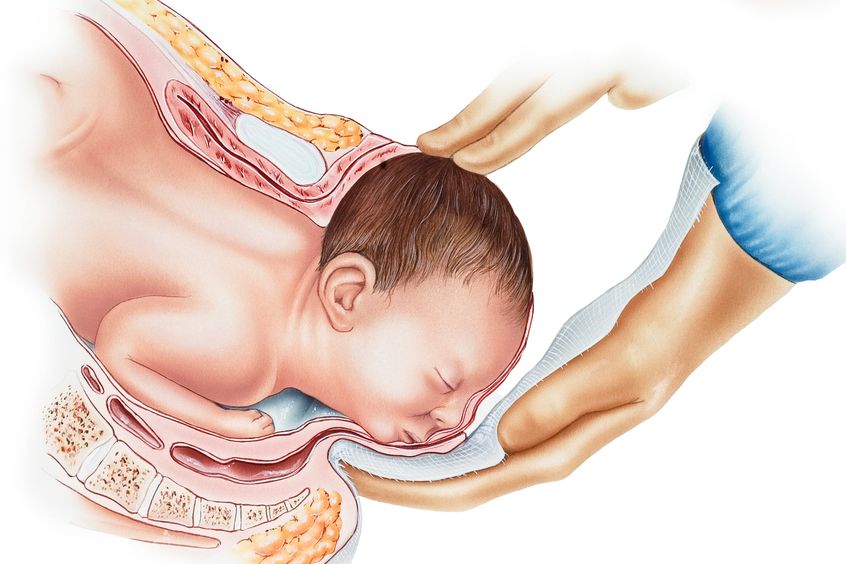 Illustration einer Geburt