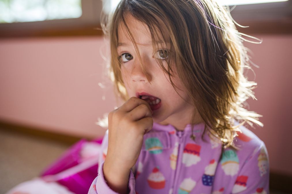 Verklebte Schamlippen Bei Kleinen M Dchen Swissmom