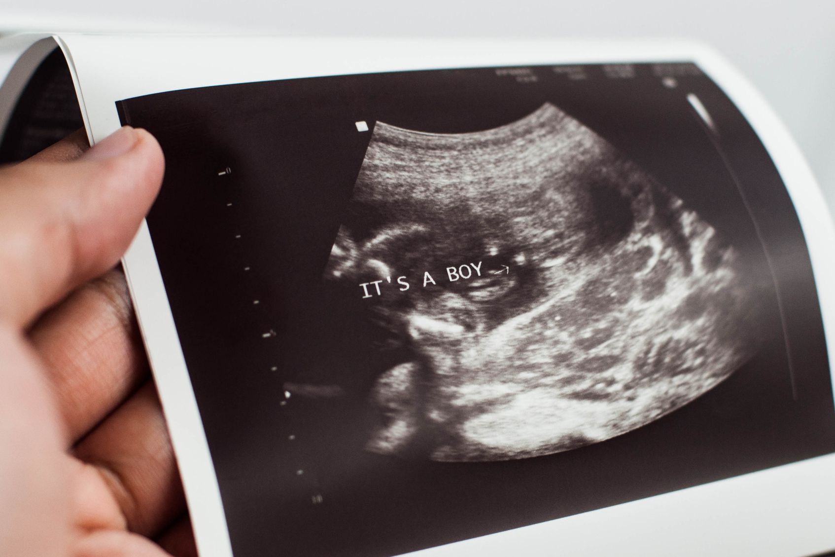 Hand mit Ultraschallbild eines Jungen