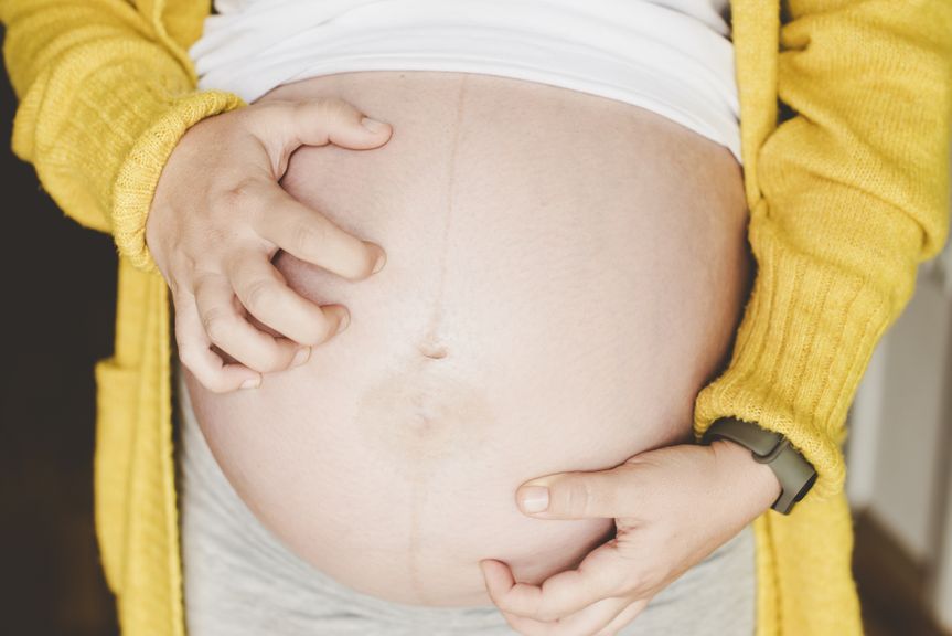Schwangere kratzt sich am Bauch