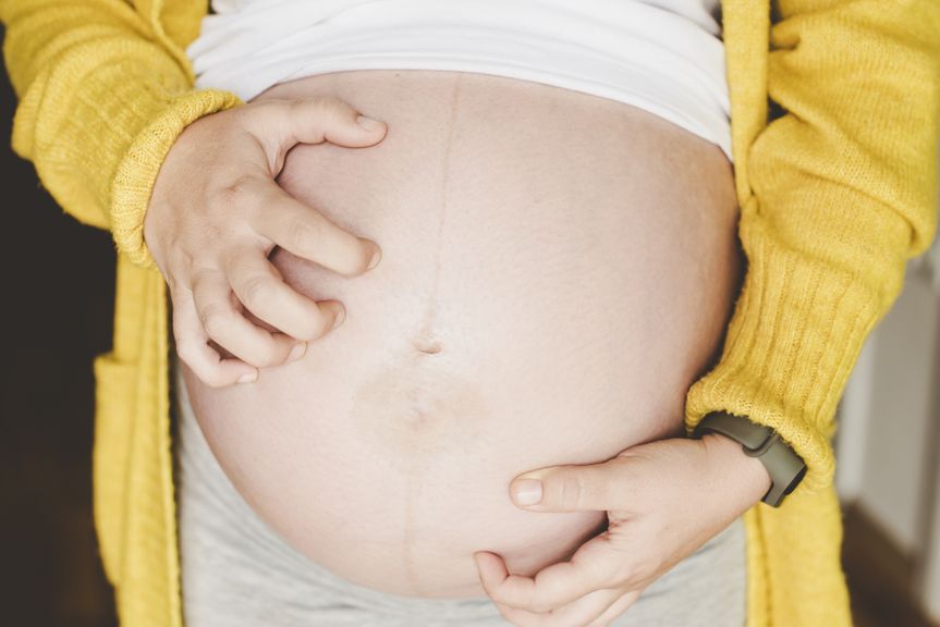 Schwangere kratzt sich am Bauch