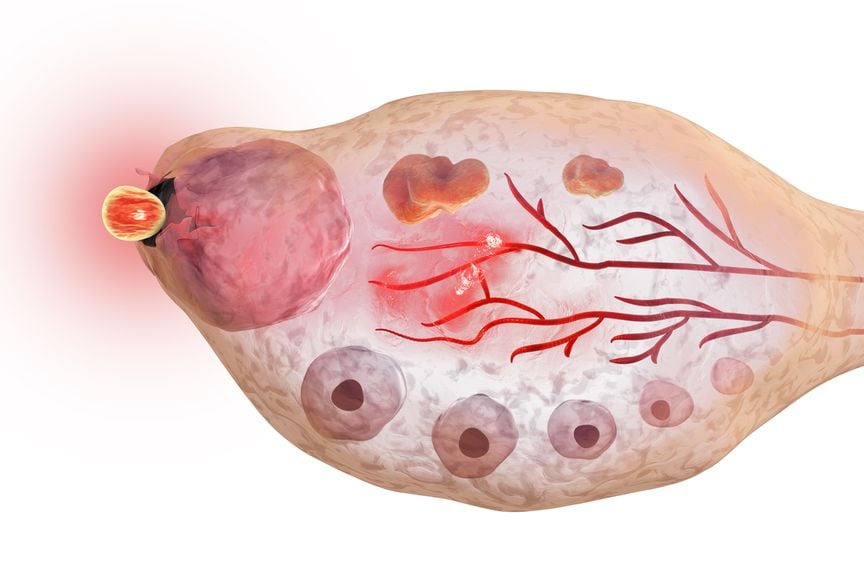 Ovulation im weiblichen Eierstock,Weiblicher Eierstock,Eisprung 