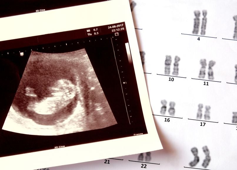 Ultraschallbild mit Chromosomen-Analysebericht