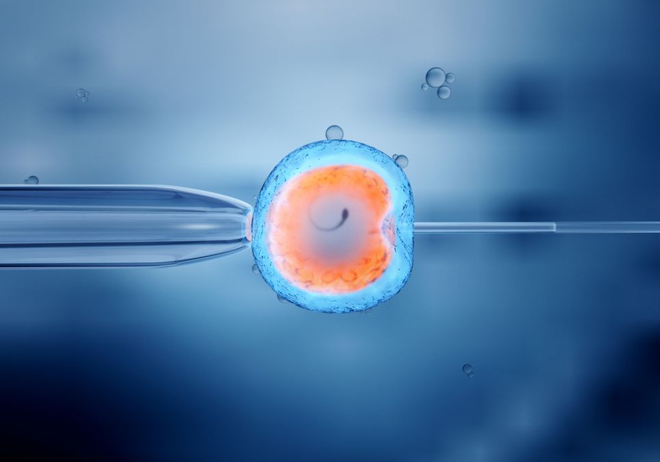 ICSI | Befruchtung bei schlechter Spermienqualitt | swissmom
