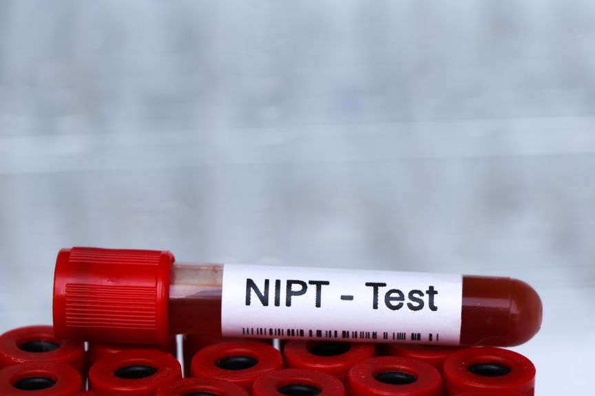 Blutröhren für NIPT-Test