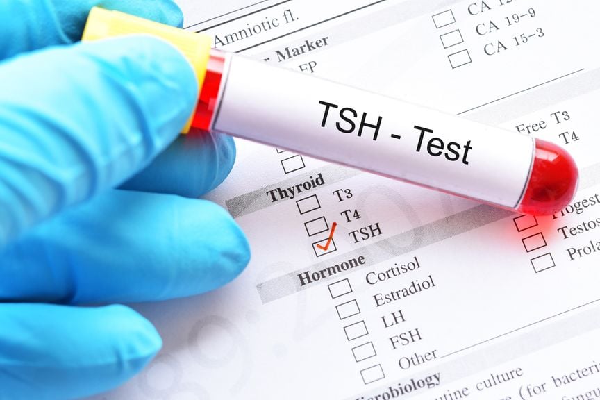 Test für Schilddrüsen stimulierendes Hormon