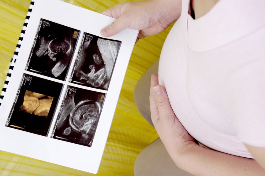 Schwangere mit Ultraschallbildern