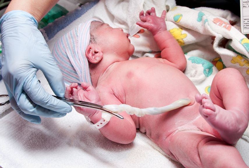 Neugeborenes mit der Nabelschnur Minuten nach der Geburt
