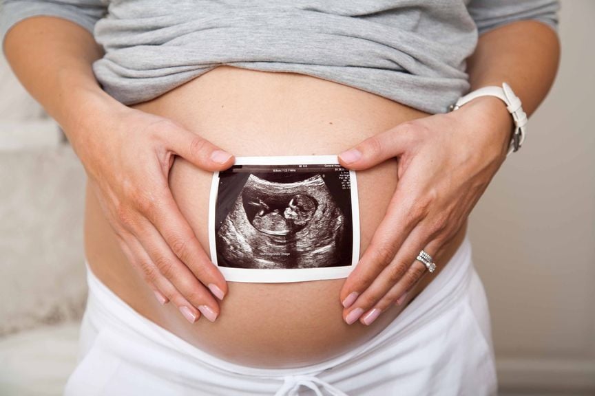 Schwangere mit Ultraschallbild 