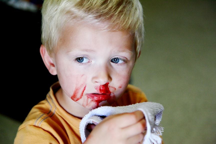 Kind mit blutverschmiertem Gesicht